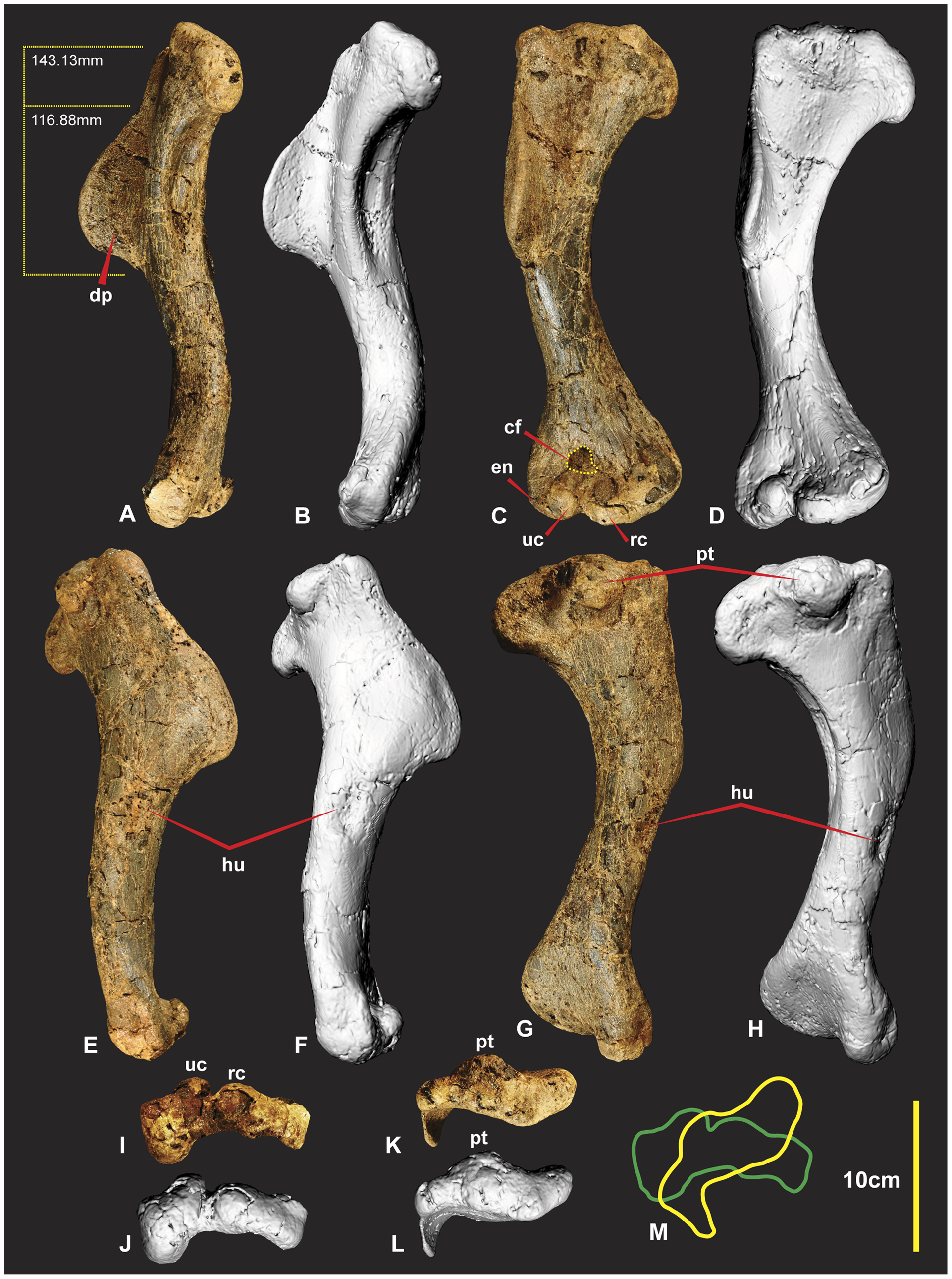 Figure 3. Right Humerus.