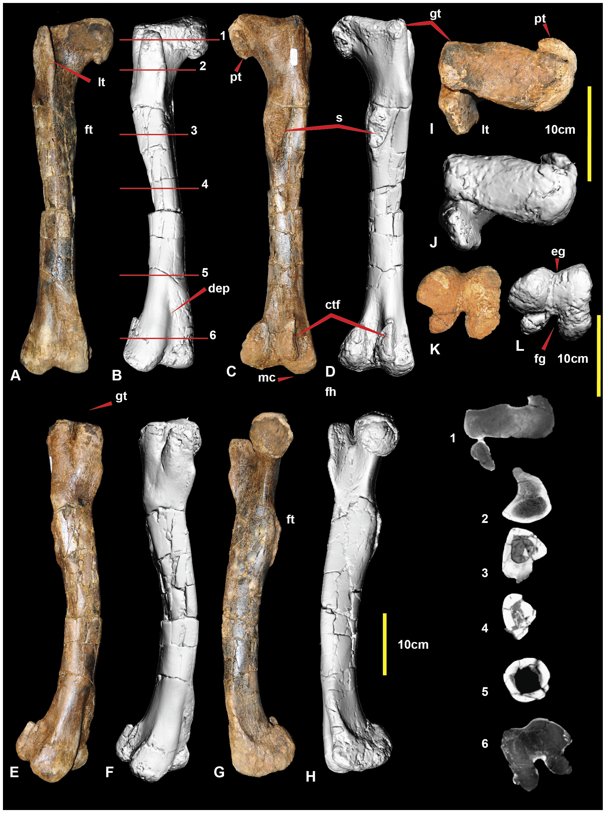 Figure 2. Right femur.