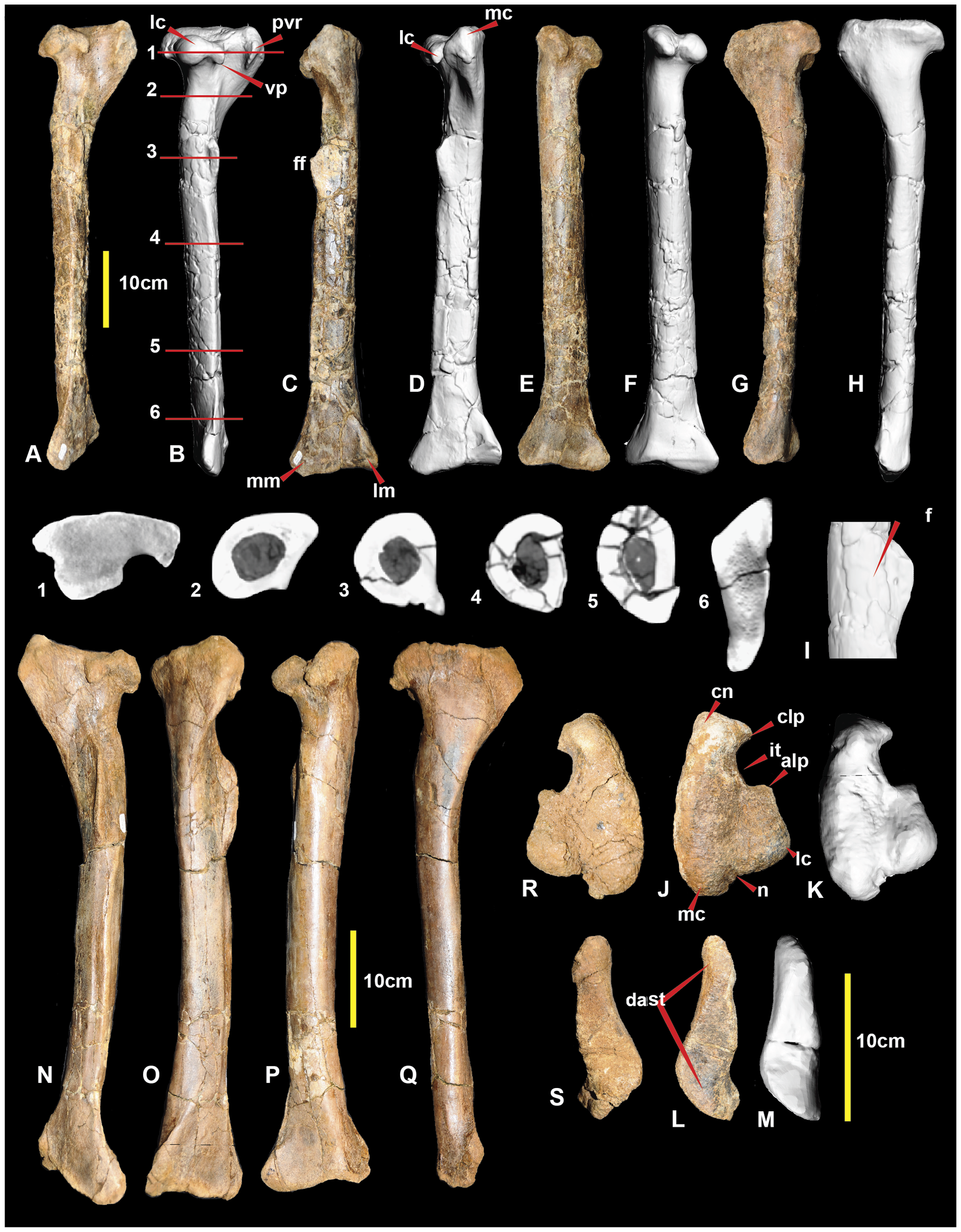 Figure 3. Right and left tibia.