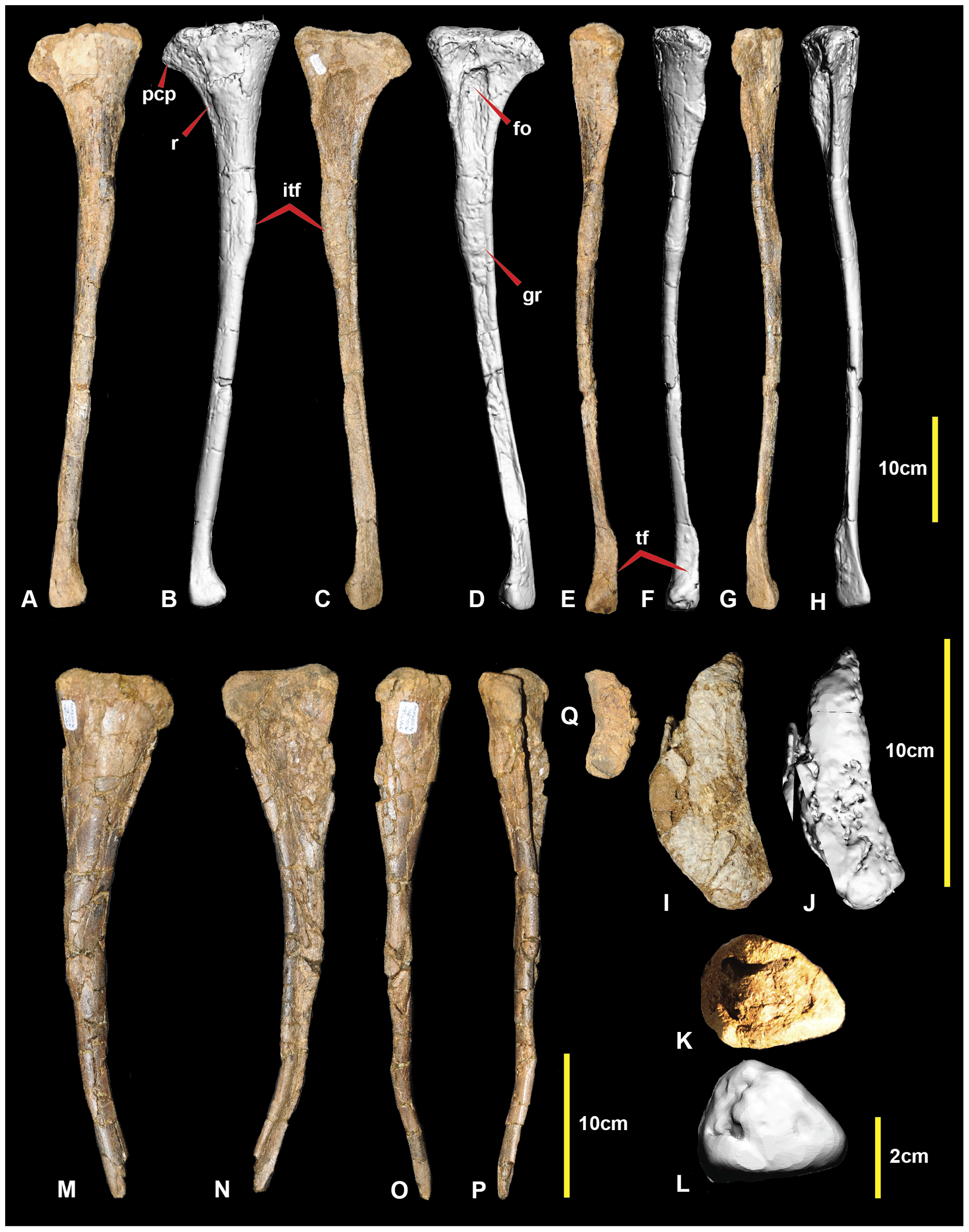 Figure 4. Right and left fibula.