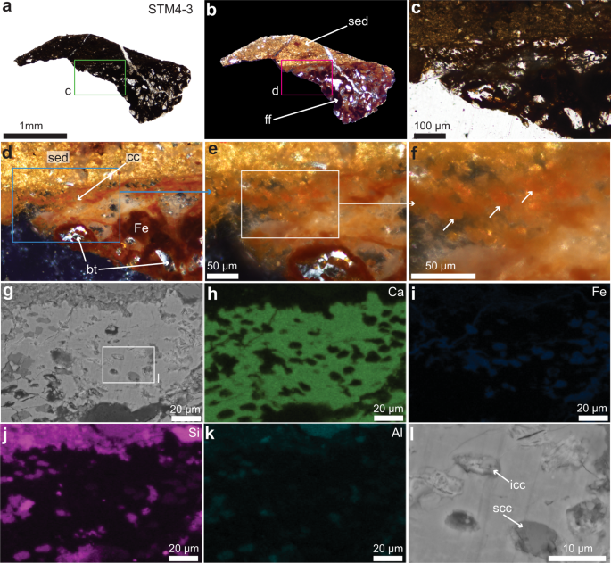 Fig. 2: Photographs of a fragment of the articular cartilage of STM4-3 seen with multiple microscopy methods.
