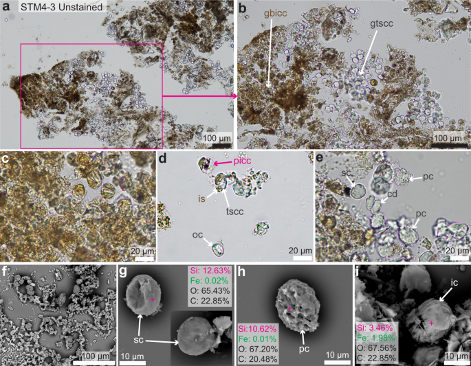 Fig. 3: Photographs of unstained paraffin sections and SEM images of the demineralized cartilage of STM4-3.
