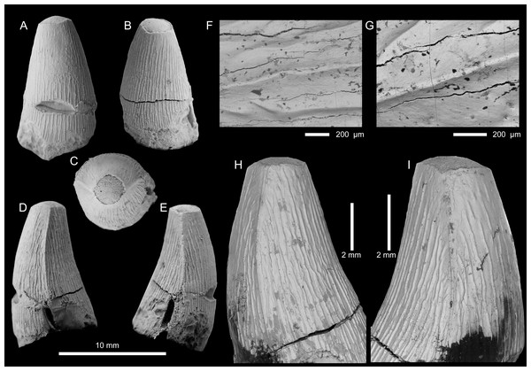 Figure 2: Thalattosuchia indet. tooth crown (PIN 5819/5) from the lower Bajocian of Tonkiy Gully, Volgograd Oblast, Russia. (A–E) Tooth crown in labial (A), lingual (B), apical (C), and mesial/distal (D, E) views. F, G, SEM photographs of the carina. Magnified SEM photographs of (C) and (D) are (H) and (I) respectively. Download full-size image DOI: 10.7717/peerj.15781/fig-2