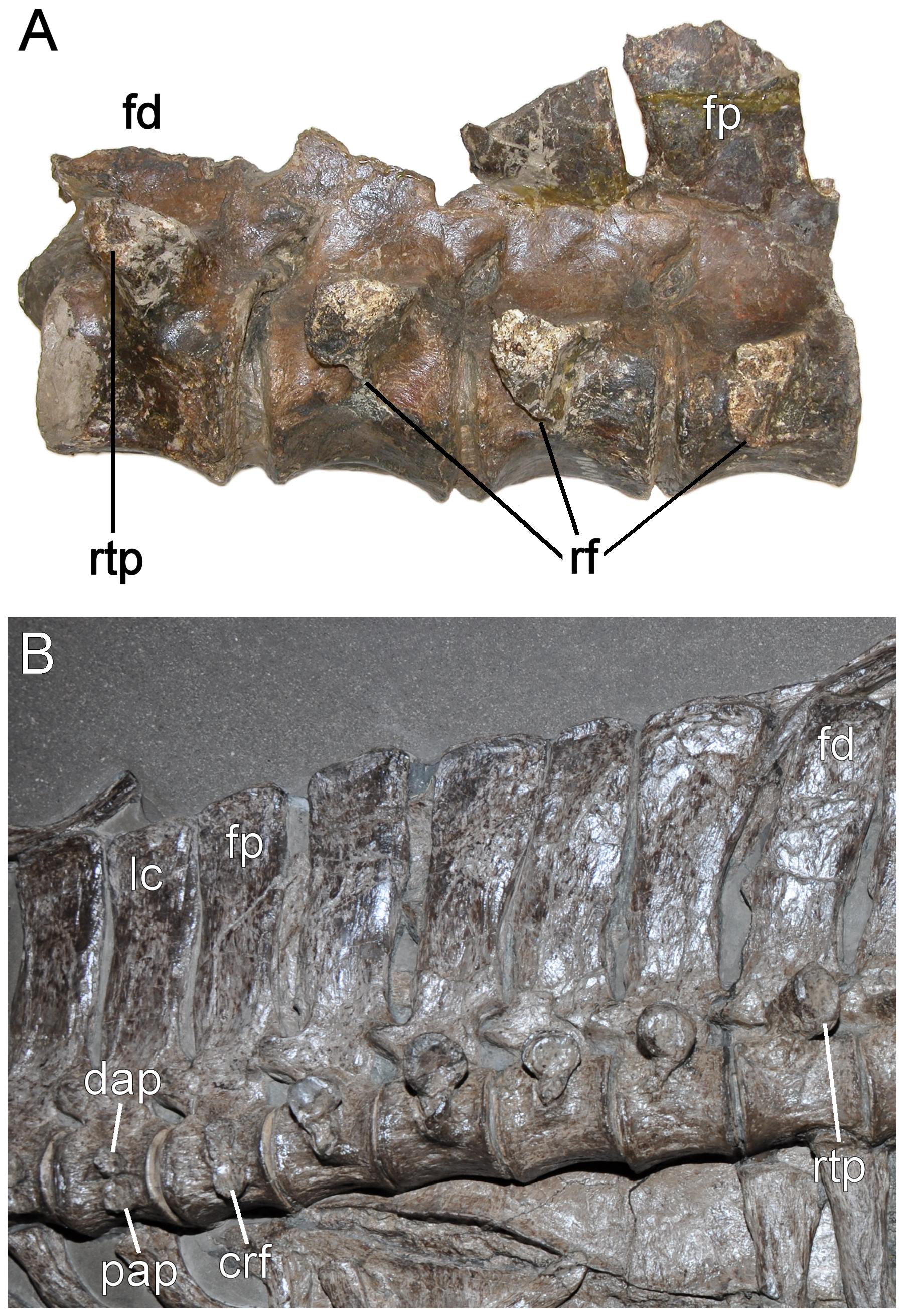 Figure 3. Pectoral series.