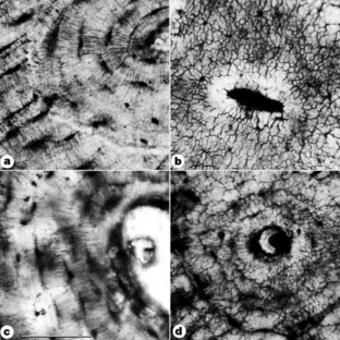 Figure 2: Canalicular organization in transverse thin sections of various bone types.