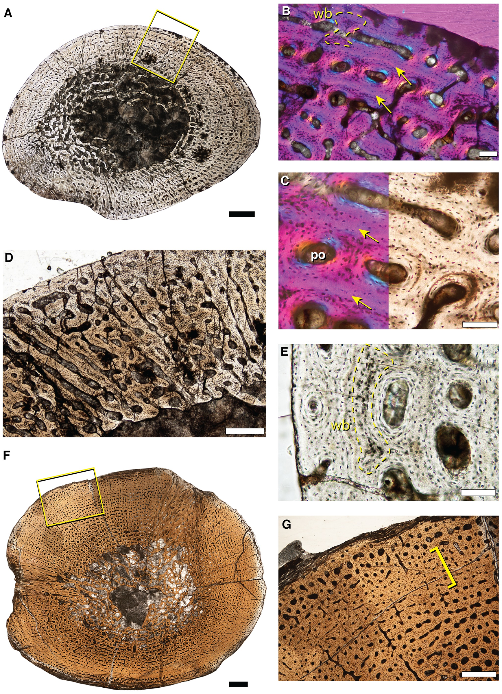 Fig 3. Representative bone histology of Size Class II from the mid-shafts of Lystrosaurus sp. hind limb elements.