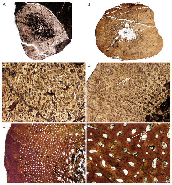 Figure 3: Transverse sections of the bone histology of Lystrosaurus maccaigi , Age Class I. (A) NMQR 3658a humerus showing an infilled medullary cavity. (B) NMQR 3641 tibia showing a thick cortex surrounding a small medullary cavity. (C) NMQR 3658a humerus showing woven fibered bone with primary osteons. (D) NMQR 3658b radius showing highly vascularized primary bone tissue. (E) NMQR 3641 tibia showing highly vascularized primary bone tissue. (F) High magnification of NMQR 3641 tibia showing the 