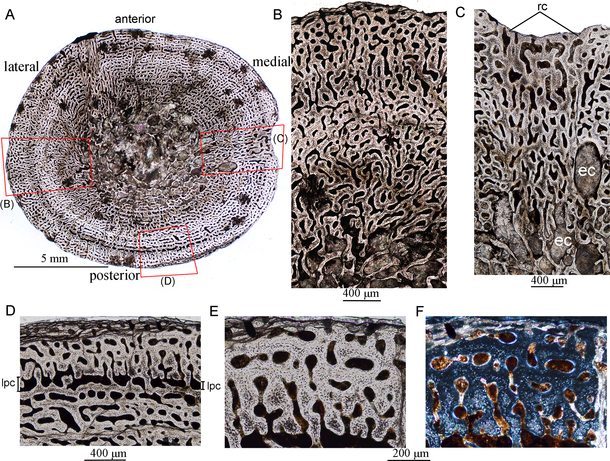 Fig 1. Bone microstructure in juvenile Lystrosaurus IVPP V26543.