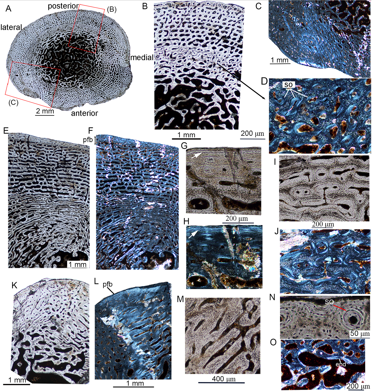 Fig 2. Bone microstructure in juvenile Lystrosaurus IVPP V26544.