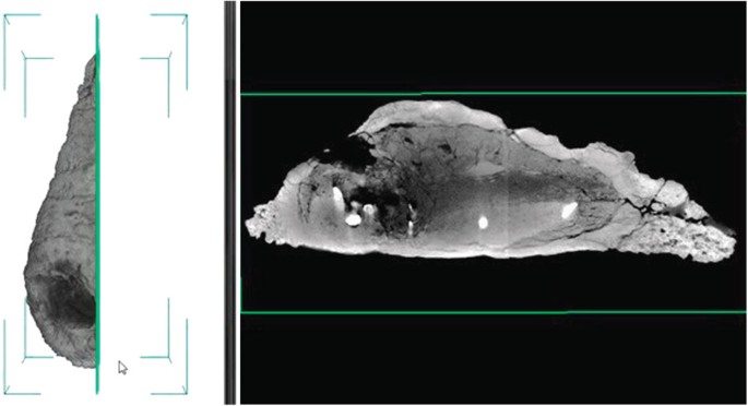 Figure 2: CT-scan image of an adult Rapetosaurus krausei osteoderm.